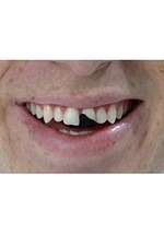Tooth Wax